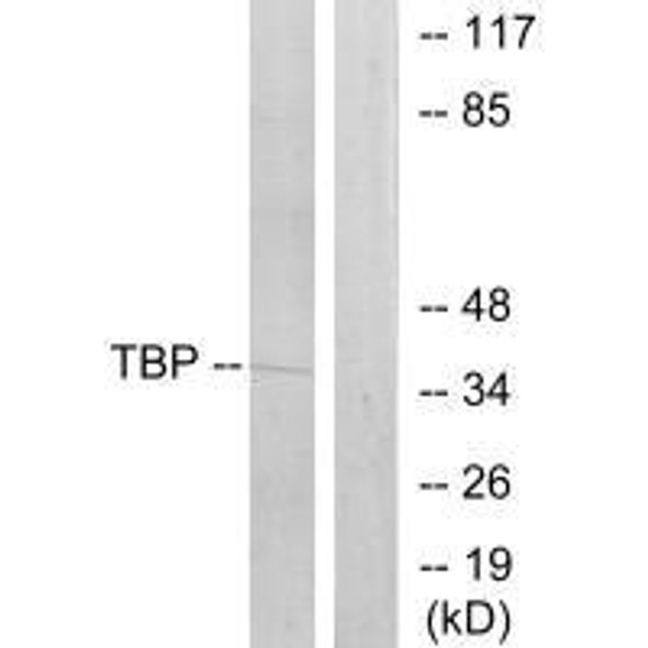 TBP Antibody (PACO21748)