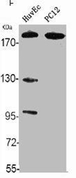 ABCA8 Antibody (PACO06215)