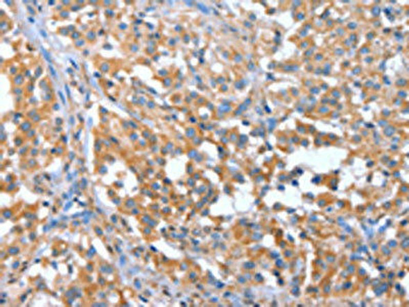 NOD2 Antibody (PACO19388)