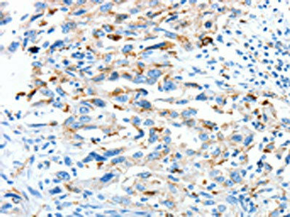 CLPTM1L Antibody (PACO19487)