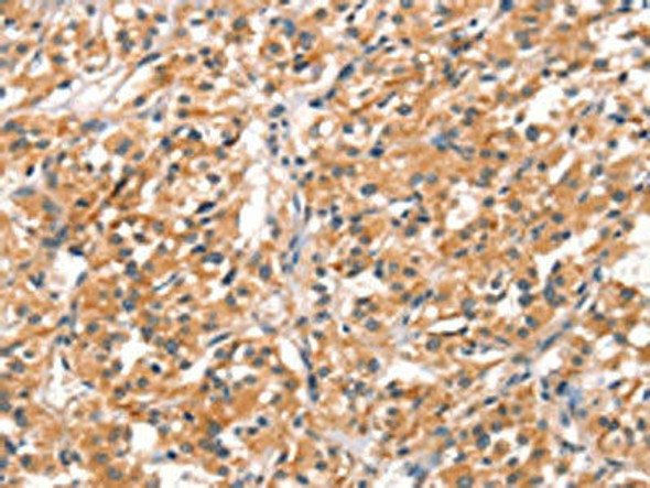 RHOBTB2 Antibody (PACO19546)