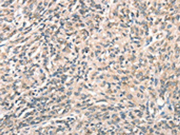 DECR1 Antibody (PACO19554)