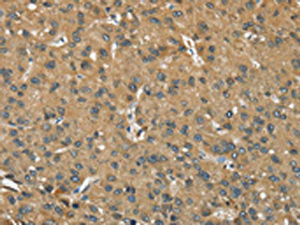 OPRD1 Antibody (PACO19559)