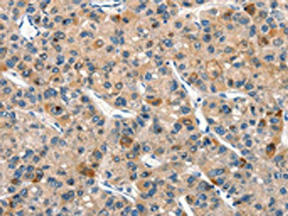 DUSP2 Antibody (PACO19585)