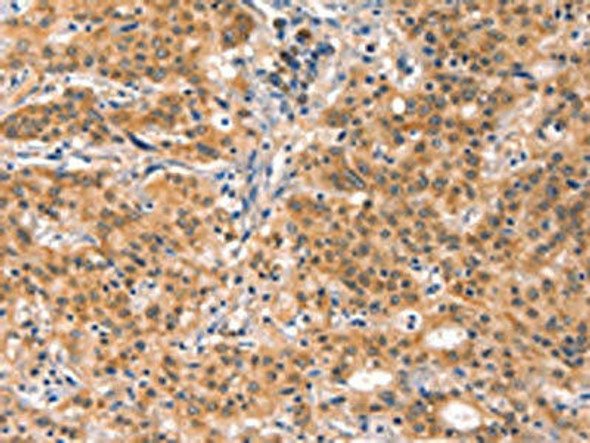 EIF4G1 Antibody (PACO19593)