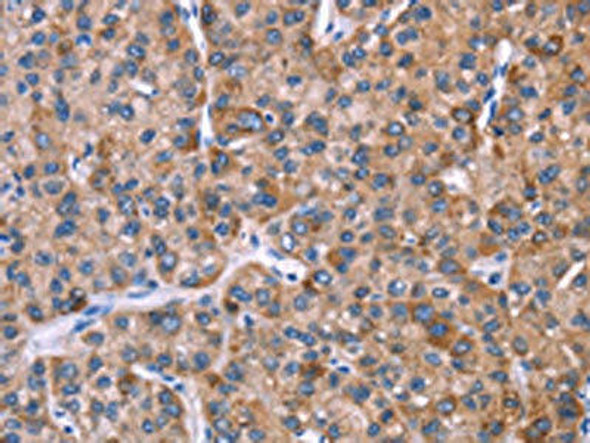 EVC2 Antibody (PACO19628)