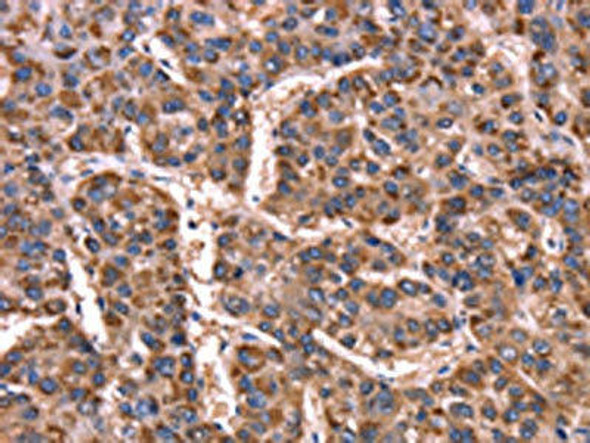 GCG Antibody (PACO19635)
