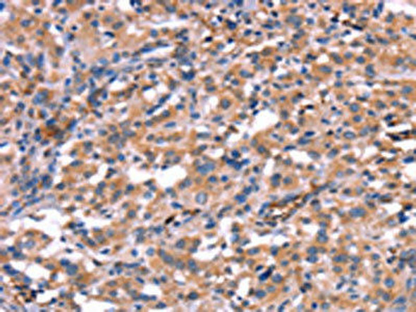 HMGCS1 Antibody (PACO19764)