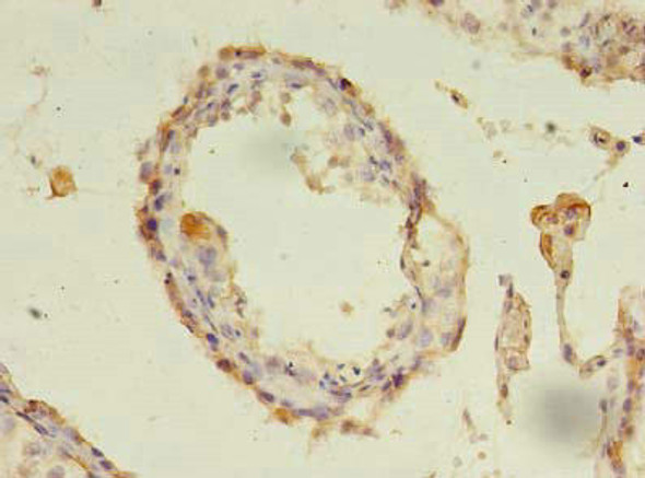 CXADR Antibody (PACO26045)