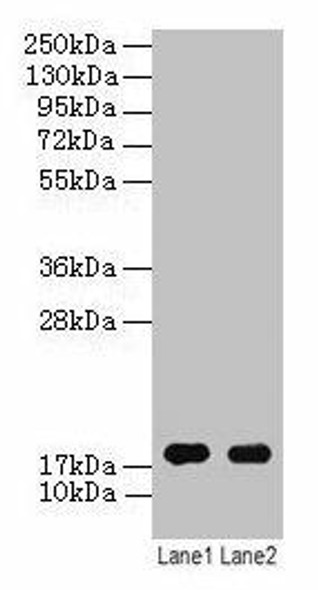 ATP5F1D Antibody (PACO26081)