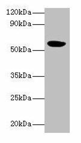 HARS2 Antibody (PACO27301)