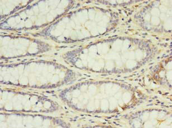 IL2 Antibody (PACO27605)