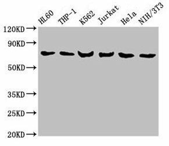 LCP1 Antibody (PACO27917)