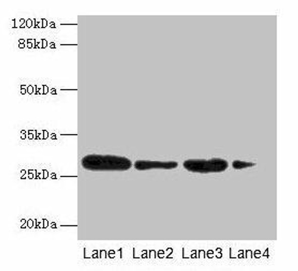 MED7 Antibody (PACO28210)