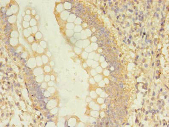 DCTN2 Antibody (PACO35370)