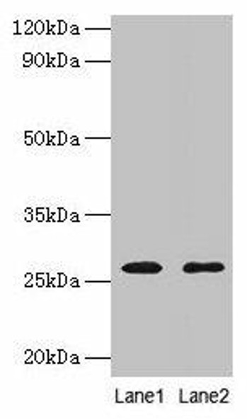 ADIPOQ Antibody (PACO35474)
