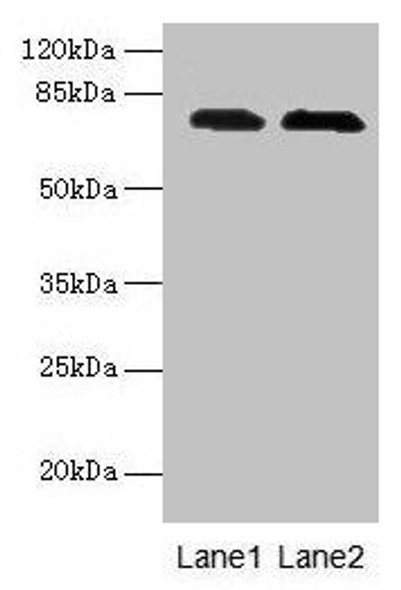 GALNT7 Antibody (PACO37398)