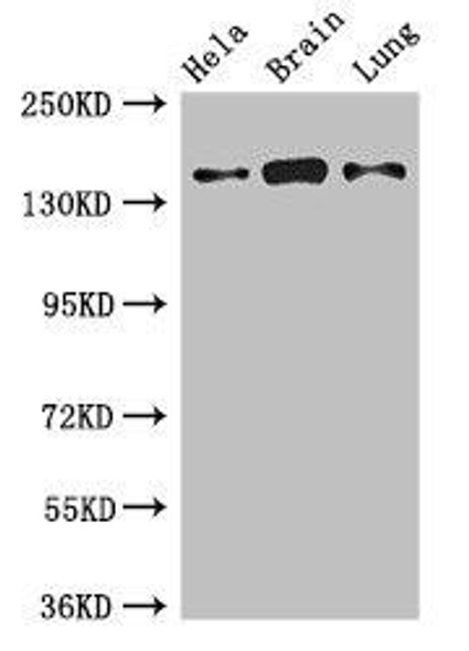 SULF2 Antibody (PACO50762)