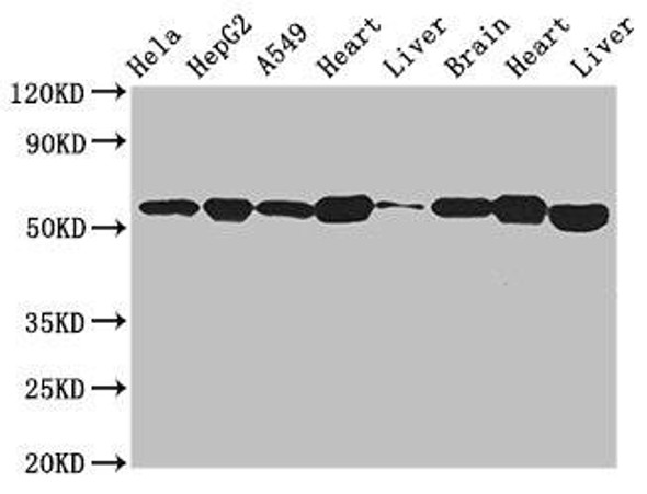 ATP5B Antibody (PACO51334)