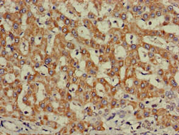 INSR Antibody (PACO51650)