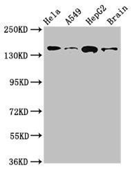 ROCK2 Antibody (PACO51922)