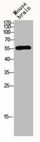 MMP13 Antibody (PACO06645)