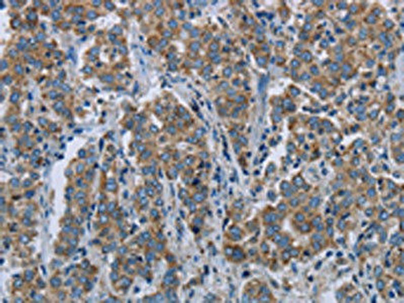 ELAVL3 Antibody (PACO19906)