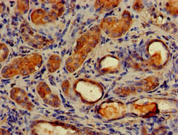 MAP1LC3C Antibody (PACO51138)