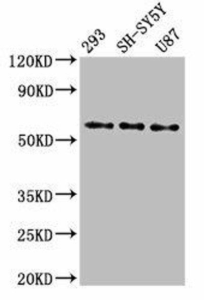 SLC11A2 Antibody (PACO54998)