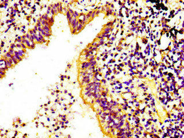 RPS6KA6 Antibody (PACO56234)