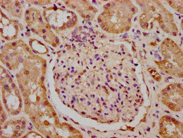 KIF23 Antibody (PACO59964)