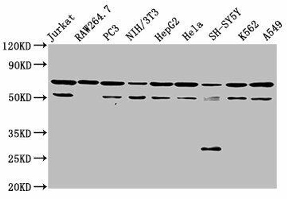 NUP62 Antibody (PACO61578)