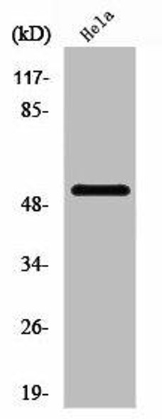 PFKFB1/PFKFB4 Antibody (PACO01324)