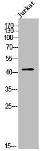 OR2AJ1 Antibody (PACO02470)