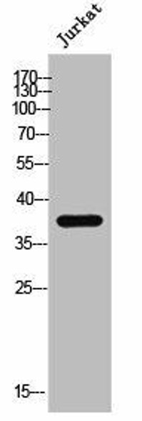 ZDHHC15 Antibody (PACO02551)