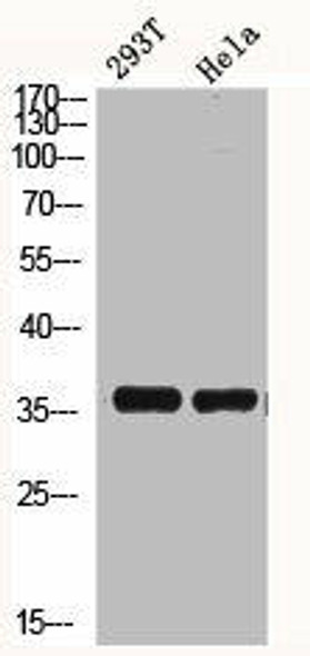 HMG20B Antibody (PACO06295)