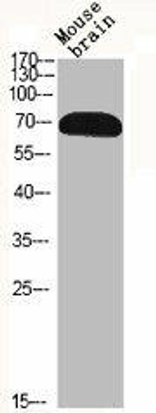 RPS6KB1 Antibody (PACO06731)