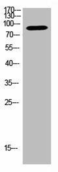 SUPT20H Antibody (PACO07459)