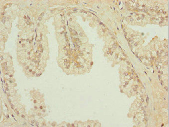 IL31RA Antibody (PACO44222)