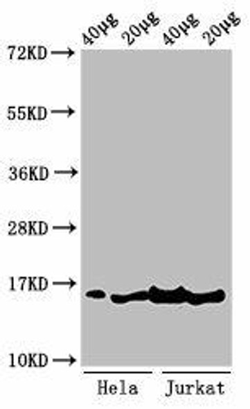 Tri-methyl-HIST1H3A (K36) Antibody (PACO56558)