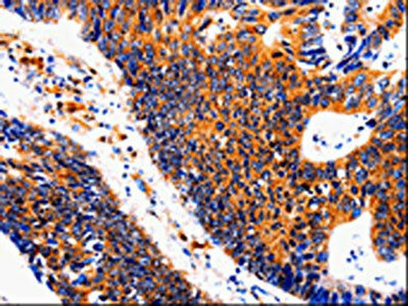 IL18BP Antibody (PACO13979)