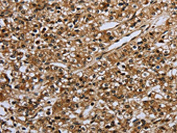 IL31RA Antibody (PACO16542)