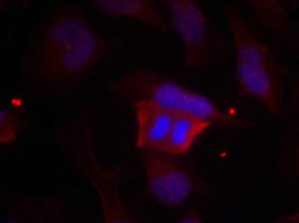 Phospho-PPP1R1B (Thr75) Antibody (PACO23863)