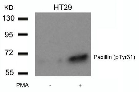 Phospho-PXN (Tyr31) Antibody (PACO23865)