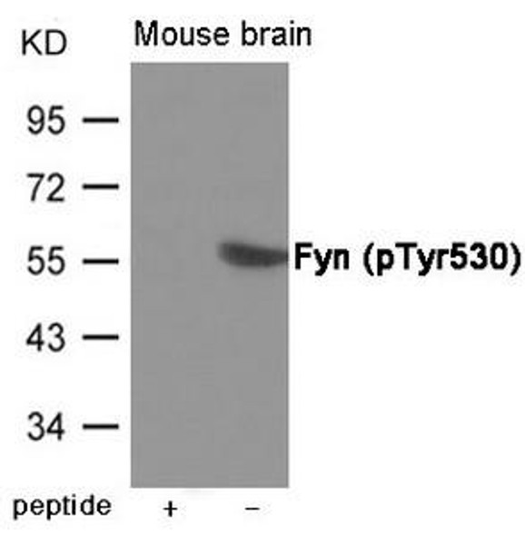 Phospho-FYN (Tyr530) Antibody (PACO23931)