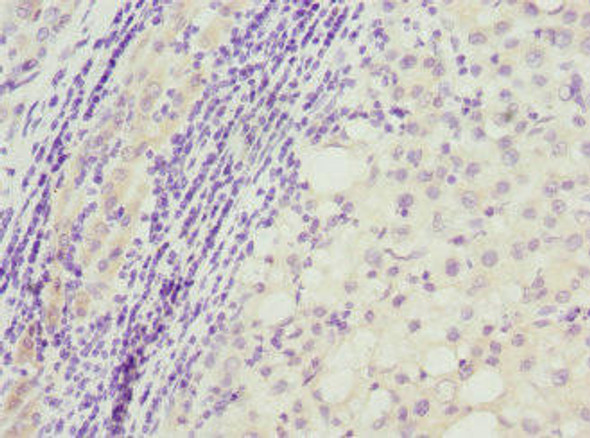 TP53AIP1 Antibody (PACO44546)