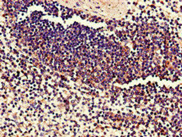 C17orf78 Antibody (PACO39406)