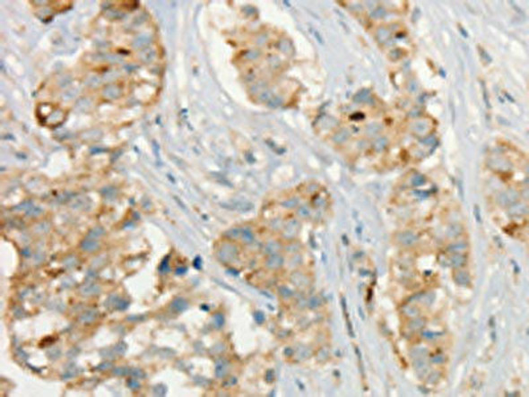 MMP9 Antibody (PACO13890)