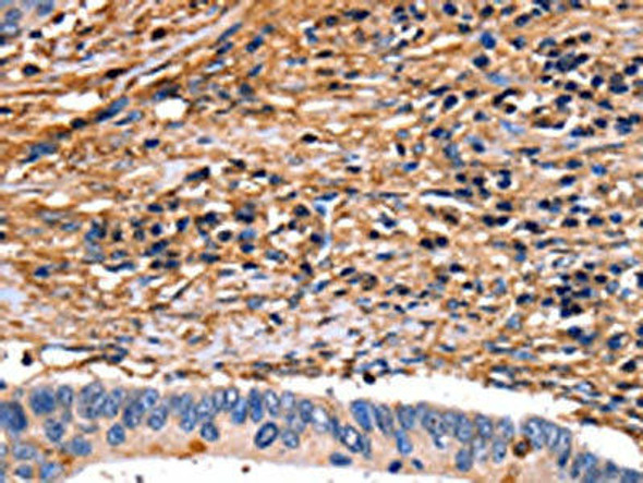 ANXA6 Antibody (PACO14040)