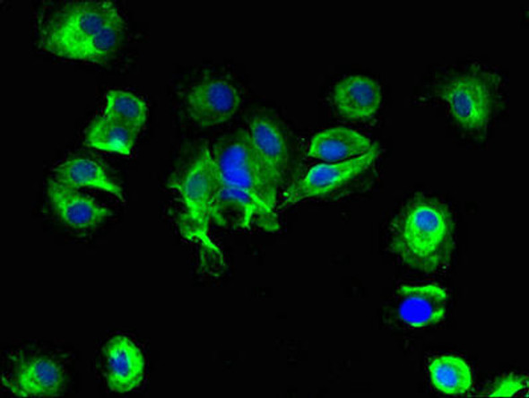 SLC25A14 Antibody (PACO29928)